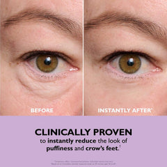 EyeLiftX™ – Instant Temporary Eye Tightener