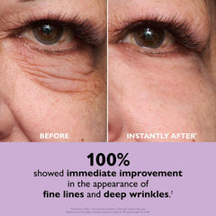 EyeLiftX™ – Instant Temporary Eye Tightener