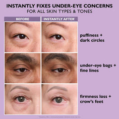 EyeLiftX™ – Instant Temporary Eye Tightener